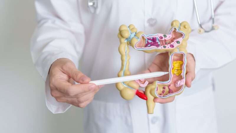 Inteligência artificial revela mistério sobre a doença de Crohn