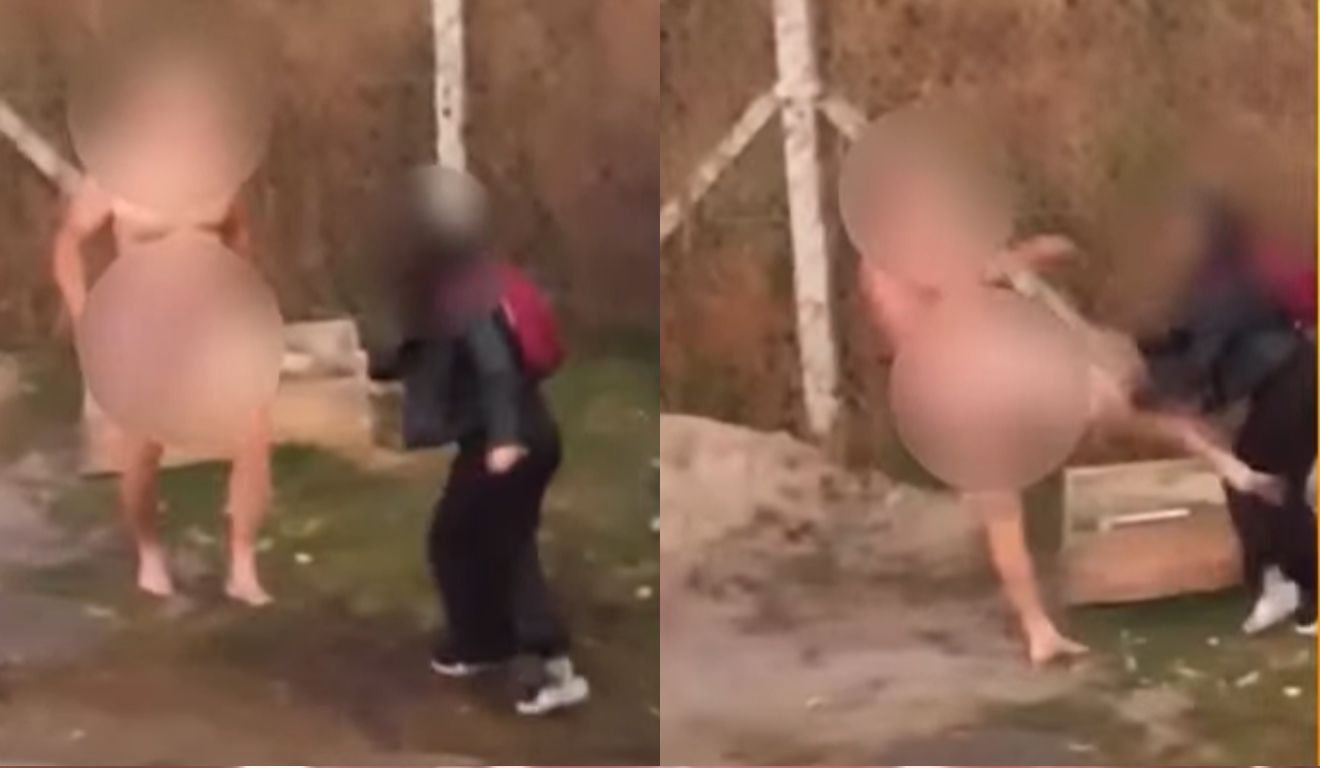 Jovem é brutalmente atacada por homem nu a caminho do trabalho em Curitiba: ‘Foi desesperador’