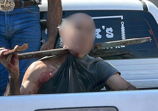 Tragédia em Xambrê: Trabalhador é Gravemente Ferido ao Cair de Árvore e Ser Atingido por Cerca