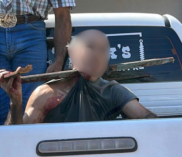 Tragédia em Xambrê: Trabalhador é Gravemente Ferido ao Cair de Árvore e Ser Atingido por Cerca