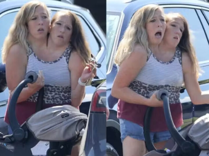 Gêmeas Siamesas Abby e Brittany Hensel Surpreendem ao Surgir com Bebê: Maternidade é um Mistério