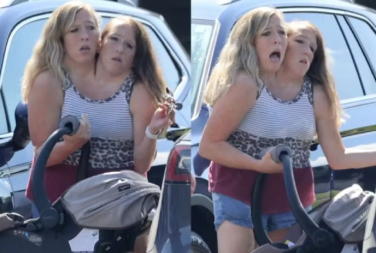 Gêmeas Siamesas Abby e Brittany Hensel Surpreendem ao Surgir com Bebê: Maternidade é um Mistério