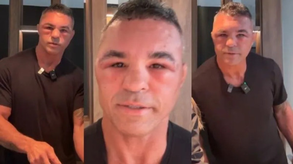 Vitor Belfort surpreende fãs com transformação radical e revela o motivo por trás da mudança