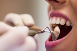dentist-examining-female-patient-with-tools-1024x683.jpg