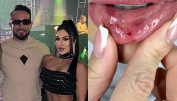 Dentista Kauany Tonndorf relata tortura por companheiro em Pinhais