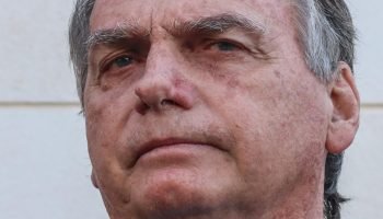 jair-bolsonaro-broncopneumonia