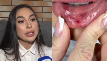 Dentista não consegue sair sozinha após mês de tortura